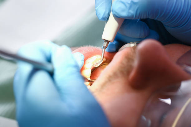 Best Emergency Tooth Extraction  in Lavaca, AR